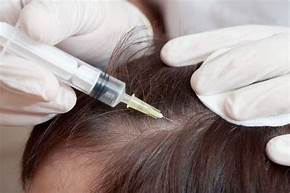 hair regeneration regrow treatment